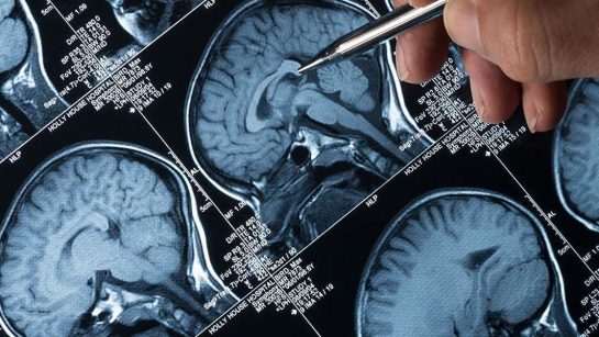 Specialised neuro-oncology opinion